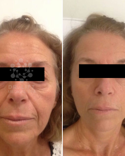 Skin Renewal