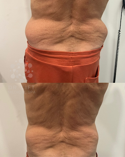 Weight Loss